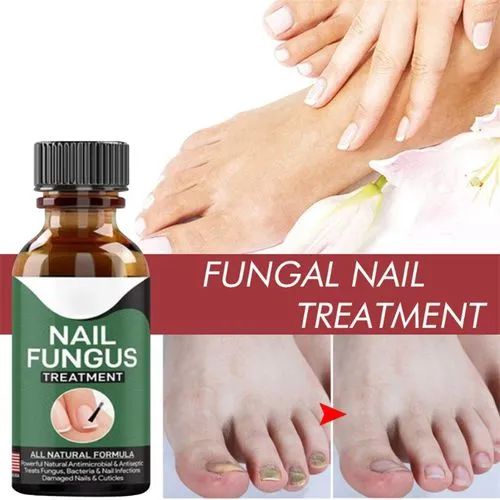 Nail Fungal Treatments Nail Repair Essences Serum, Foot Nail Fungus Removal Gel