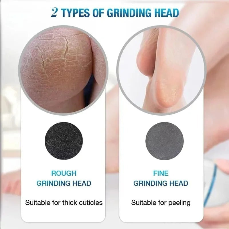 Black Callus Remover with Built-In Vacuum for Dead Skin, Cracked Heels & Calluses, Rechargeable